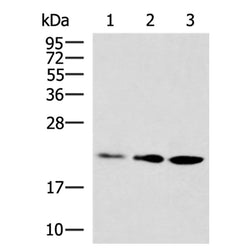 DUSP3 rabbit polyclonal antibody