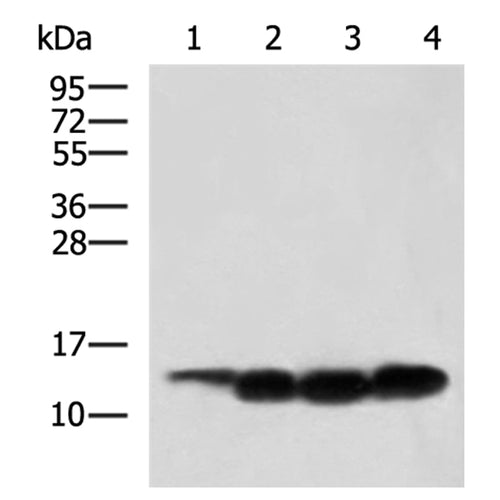 FABP3 rabbit polyclonal antibody