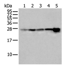 HSPB1 rabbit polyclonal antibody