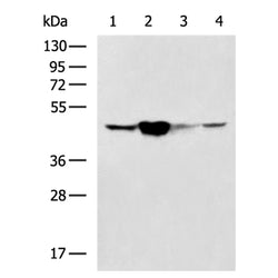 SERPINH1 rabbit polyclonal antibody
