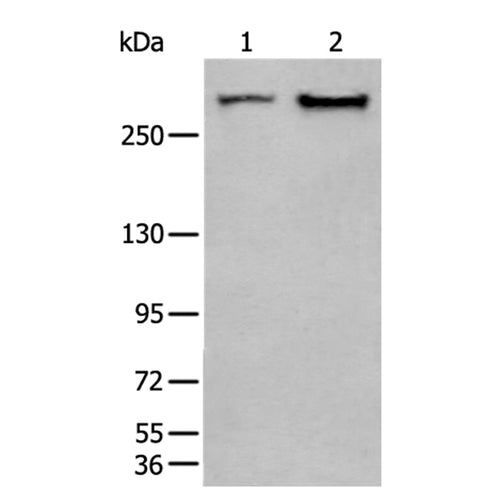 SPTA1 rabbit polyclonal antibody