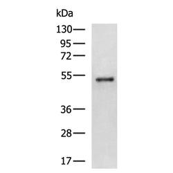 PLAG1 rabbit polyclonal antibody