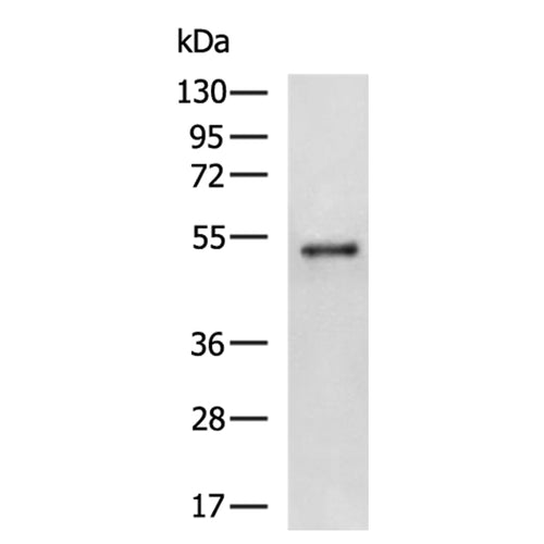PLAG1 rabbit polyclonal antibody