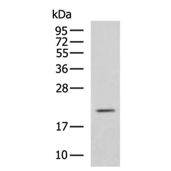 FGF10 rabbit polyclonal antibody