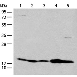 CFL2 rabbit polyclonal antibody