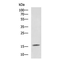MAP1LC3B rabbit polyclonal antibody