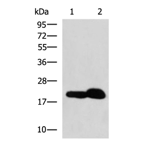 PSEN1 rabbit polyclonal antibody