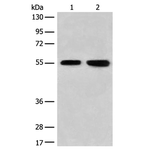 CNGA4 rabbit polyclonal antibody