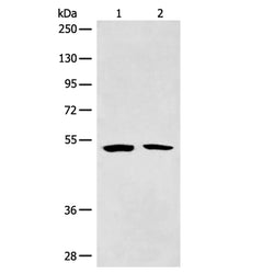 ETS1 rabbit polyclonal antibody