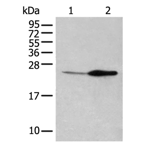 IL11 rabbit polyclonal antibody