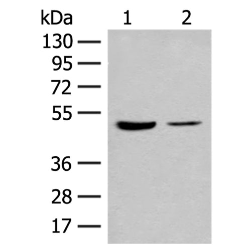 IL7R rabbit polyclonal antibody