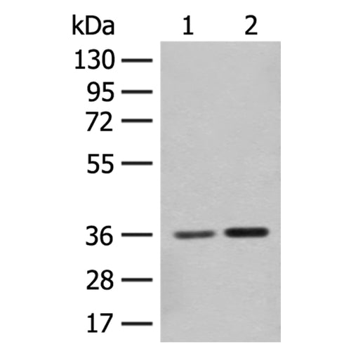 SLC25A27 rabbit polyclonal antibody