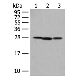 NIPSNAP2 rabbit polyclonal antibody
