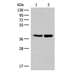 LRATD2 rabbit polyclonal antibody