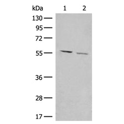 GADL1 rabbit polyclonal antibody
