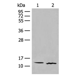 GALP rabbit polyclonal antibody