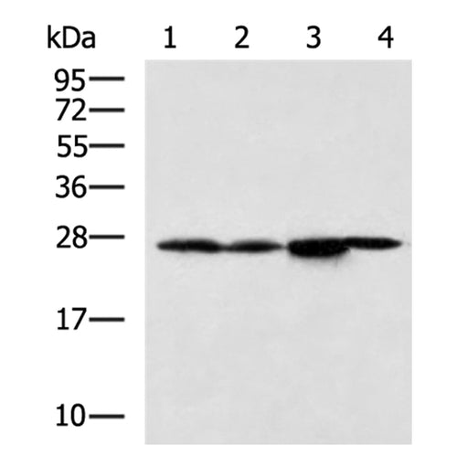 CASP14 rabbit polyclonal antibody