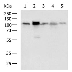 STAT6 rabbit polyclonal antibody