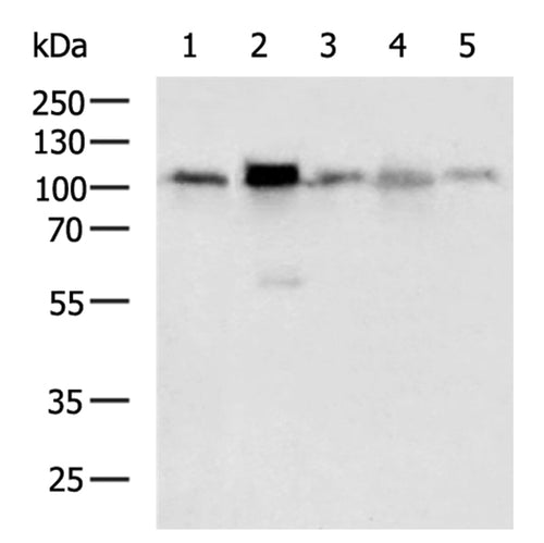 STAT6 rabbit polyclonal antibody