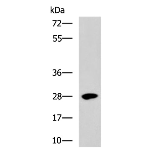 BTG3 rabbit polyclonal antibody