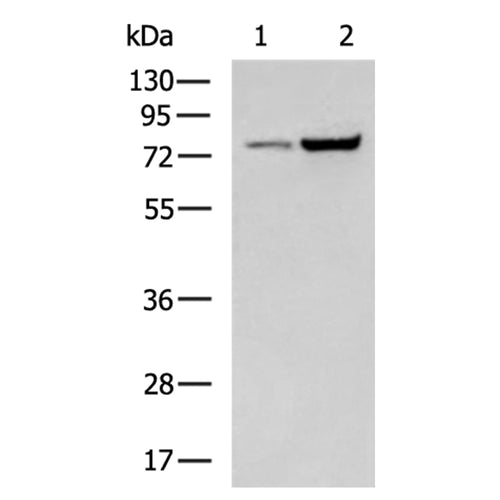 CAPN5 rabbit polyclonal antibody