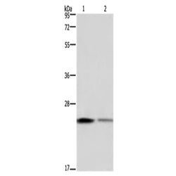 EMC8 rabbit polyclonal antibody