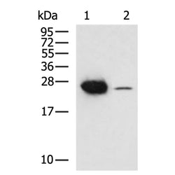 CRP rabbit polyclonal antibody