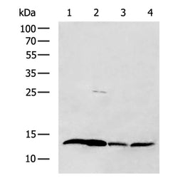 FABP2 rabbit polyclonal antibody