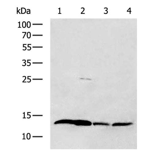 FABP2 rabbit polyclonal antibody