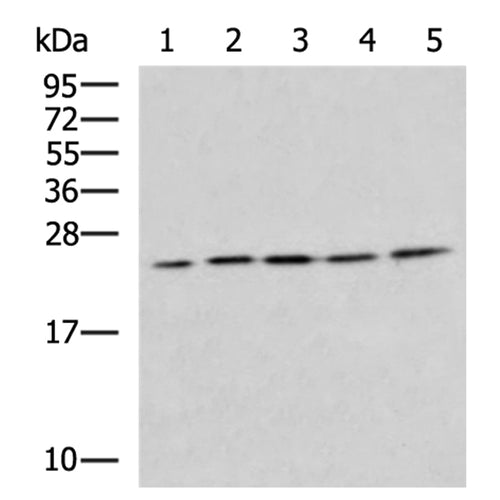 IL6 rabbit polyclonal antibody