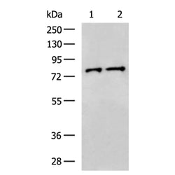 ACAD11 rabbit polyclonal antibody