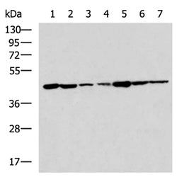 AGA rabbit polyclonal antibody