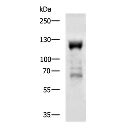 CARD14 rabbit polyclonal antibody