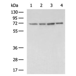IL2RB rabbit polyclonal antibody