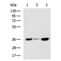 LDHC rabbit polyclonal antibody