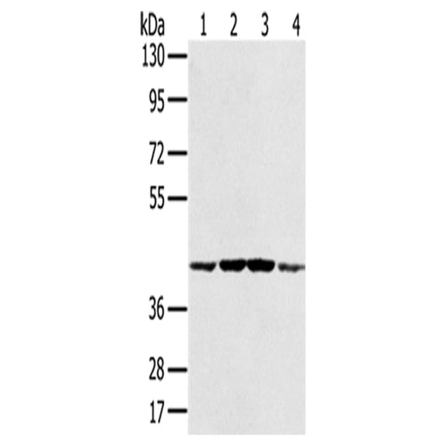PAICS rabbit polyclonal antibody