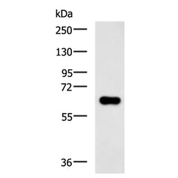PDP1 rabbit polyclonal antibody
