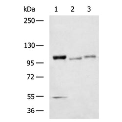 PYGL rabbit polyclonal antibody