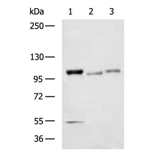 PYGL rabbit polyclonal antibody