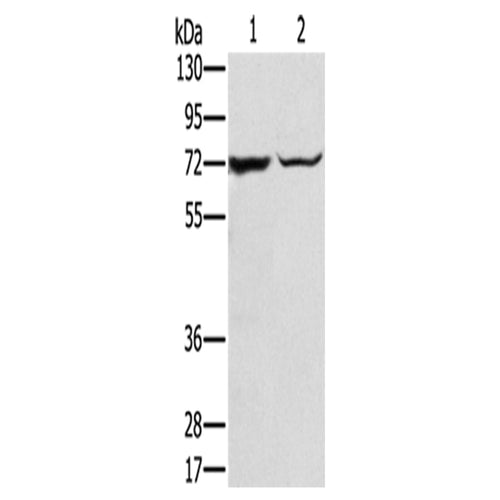 SLC25A13 rabbit polyclonal antibody