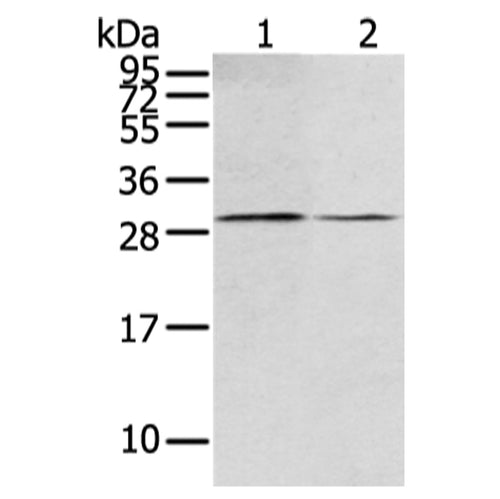 RASD2 rabbit polyclonal antibody