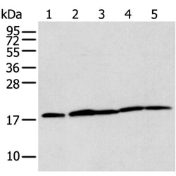 TIMM17A rabbit polyclonal antibody