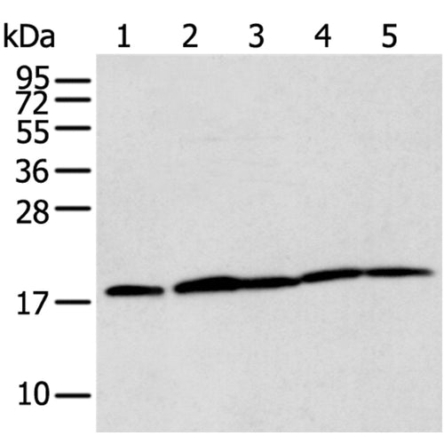 TIMM17A rabbit polyclonal antibody