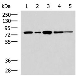 TLK2 rabbit polyclonal antibody