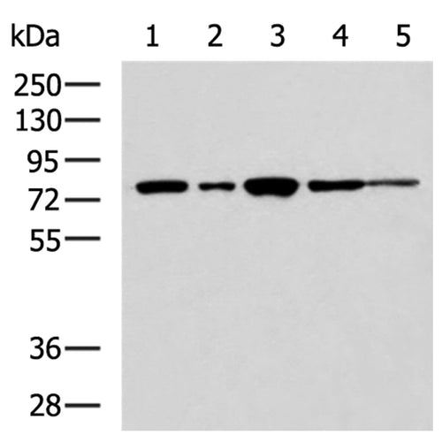 TLK2 rabbit polyclonal antibody