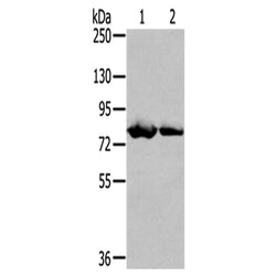 TGM5 rabbit polyclonal antibody