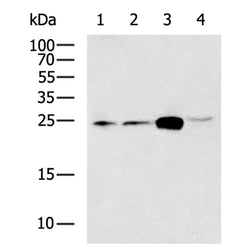 TREM1 rabbit polyclonal antibody