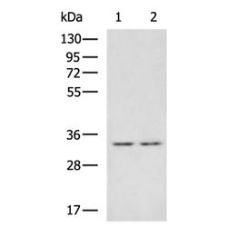 ZFAND1 rabbit polyclonal antibody