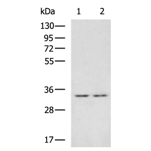 ZFAND1 rabbit polyclonal antibody