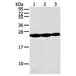 NDUFB10 rabbit polyclonal antibody